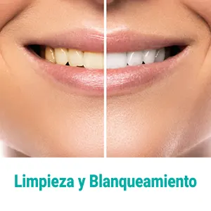 limpieza-y-blanqueamiento-dental