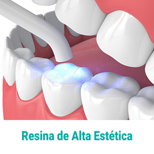 resina-dental