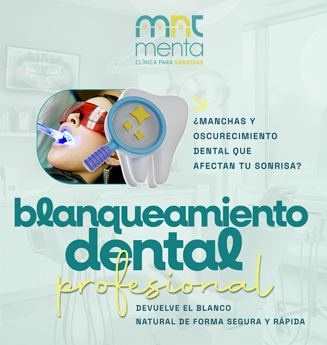 blanqueamiento-dental