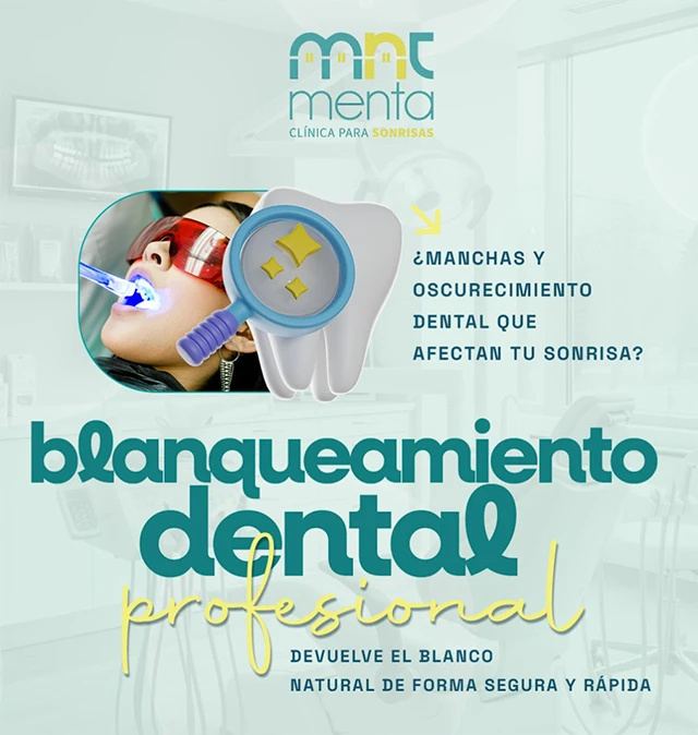 blanqueamiento-dental-opt