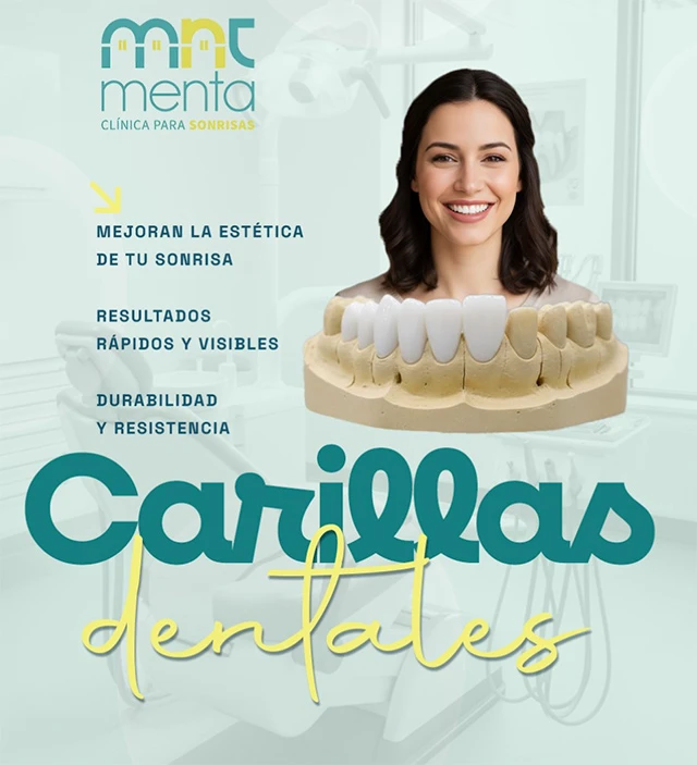 carillas-dentales-opt