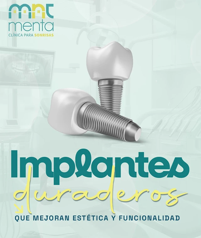 implantes-dentales-opt